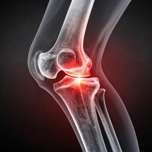 Anti-inflammatory Properties